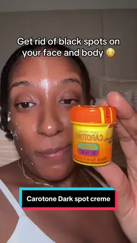 The dark spot crème will get you right quickly! #carotone #darkspots #acne #tiktokshopcreatorpicks #tiktokshopfalldealsforyou 