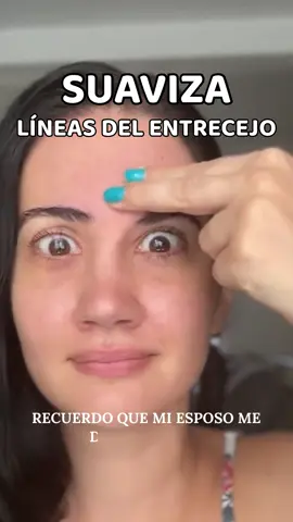 Durante años esas líneas entre mis cejas contaban una historia de estrés y cansancio 😔 Hasta que el yoga facial me ayudó a relajar no solo mi rostro, sino también mi mente 💆‍♀️ Hoy mi expresión se ve más suave, mi mirada más tranquila… y hasta mi relación con los demás ha cambiado 💖 A veces la mejor inversión no está en una crema, sino en ti misma 🌷 ✨ Si quieres probar la rutina que a mí me funcionó, la encuentras en el link de mi perfil #cuidadodelapiel #rejuvenecimiento #yogafacial #arrugas #pielbonita 