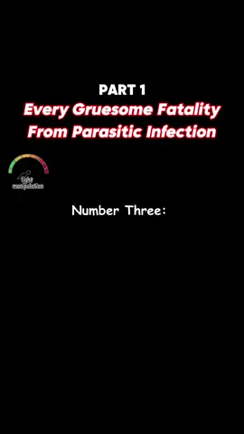 #parasiticinfection #medicalmysteries 