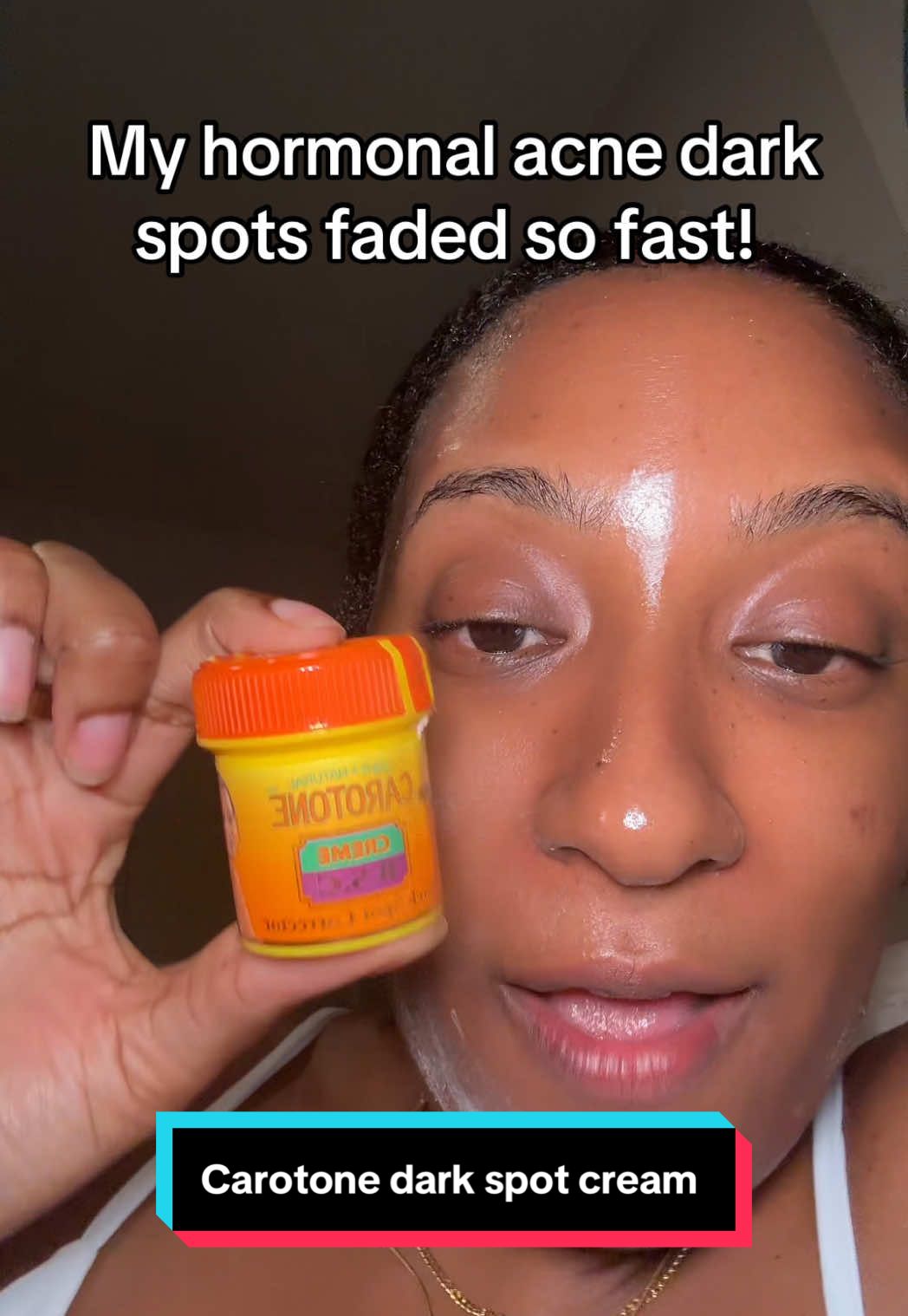 I never seen my dark spots fade so quickly 😳 #carotone #darkspots #acne #tiktokshopcreatorpicks #tiktokshopfalldealsforyou  