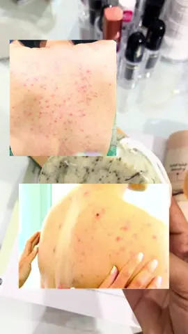 #arvea #arvea_nature #arvea_صحة_لينا 