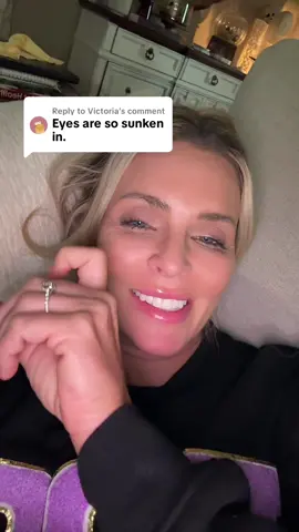 Replying to @Victoria thanks for noticing Victoria 😘😘😘 #prftreatment #fyp 