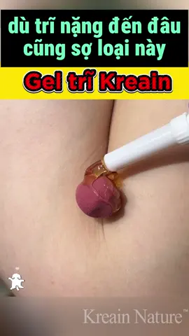 Đã có 1.380.000 người sử dụng và cho đánh giá 5sao trên toàn quốc. Đây là sản phẩm được các chuyên gia hàng đầu khuyên dùng.