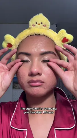 the itch it scratches too omggg 😫 #lashes #kisslashes #falsies #gurwm #getunreadywithme #makeup #foryou #fypage #asian #filipino #newyork #texturedskin #acneproneskin 