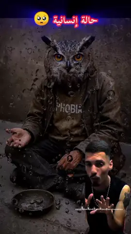 وينك يا الكينغ 🥺💔#phobia_isaac #kxrimlive @Phobia Isaac 