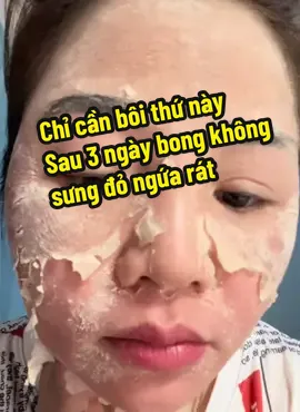 Phương pháp peel da tinh chất loại bỏ sạch sắc tố nám tàn nhang bong sau 3 ngày peel tại nhà ##TikTokAwardsVN #yodyphuonganh #táitạoda #nám_tàn_nhang_mụn_thâm #peelda  @Shop tái tạo da phương anh 