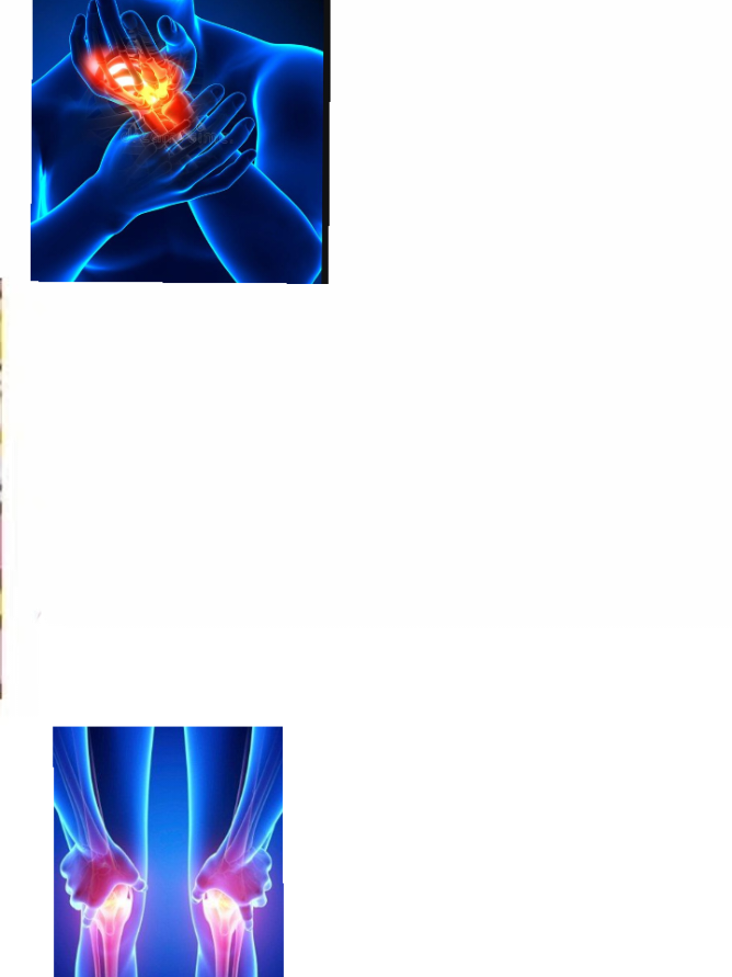 #porteros #lesionesfísicas #dolor #raw #ñaña 