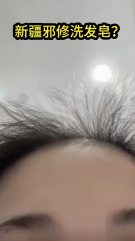 Stress rụng tóc cứ em này mà gội #kichmoctoc #tamgiaclabach 