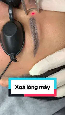 Xoá mày siêu sạch.