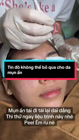 🎥 DA MỤN ẨN KHÓ CHỊU – GIẢI PHÁP CHO LÀN DA SẠCH MỊN Mụn ẩn nhìn thì nhỏ nhưng sờ lên lại sần sùi, khó chịu vô cùng 😣 Da thì cứ xỉn màu, make up không ăn, dưỡng mãi chẳng thấm… Tại Kim Chi Beauty, liệu trình peel da bằng hoạt chất Salicylic giúp: ✨ Làm sạch sâu lỗ chân lông ✨ Giảm bít tắc – nguyên nhân khiến da nổi mụn ẩn ✨ Cải thiện bề mặt da mịn màng hơn sau mỗi buổi chăm sóc 💧 Kết hợp sản phẩm dược mỹ phẩm châu Âu, quy trình an toàn – nhẹ nhàng, da không bong tróc mạnh mà vẫn căng bóng, sáng khỏe rõ rệt#kimchibắcninh #dượcmypham #mụn_ẩn #peelmun#mụnthâm 