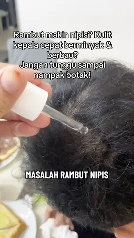 ✨ Rambut gugur? Nipis? Jangan risau! Hair Theory Serum dengan bahan Ampoule aktif bantu kuatkan akar, kurangkan keguguran, dan bagi helaian lebih tebal & sihat berkilau 💆🏻‍♀️ Rawat dari akar, bukan sekadar luaran 💧 #HairTheorySerum #RambutSihatKuat #AmpouleRambut #KurangGugur #HealthyHairGoals