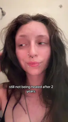 #fyp 