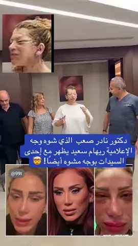 دكتور نادر صعب  الذي شوه وجه الإعلامية ريهام سعيد يظهر مع إحدى السيدات بوجه مشوه أيضًا! 🤯 #دكتور_نادر_صعب #نادر_صعب #ريهام_سعيد #ريهام_سعيدhttps #عملية_تجميل 