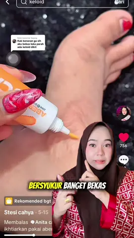 Membalas @Sayang Coba ikhtiarkan sayang ku siapa tau bekas luk4 nya bisa pudar kayak akuu ini 😍😍😍 #HilangkanBekasLukaDenganAbera #AberaScarEffect #ScarFreeJourney #SkinHealing