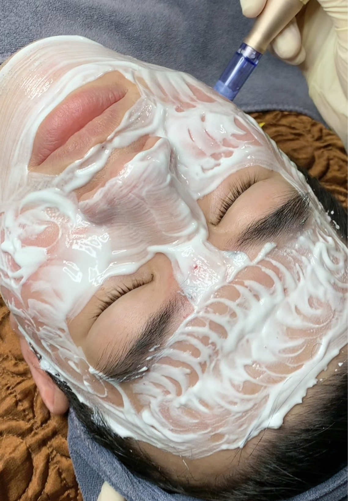 Chăm sóc da #chamsocdamun#chamsocdaseo#chamsocdanam#tanbinh#Lqspa&academy