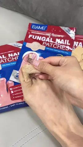 See the visible difference in your nail's color and texture. Your journey to better feet starts NOW.#tiktokshopcybermonday #elaimeifungalnailspatch #tiktokshopblackfriday #toenailfungus #fungalnails #beforeandafter #antifungal #fungalinfection #tiktokshopfalldealsforyou #freeshipping #fungalnailsolution #footcare #nailtiktok #fyp