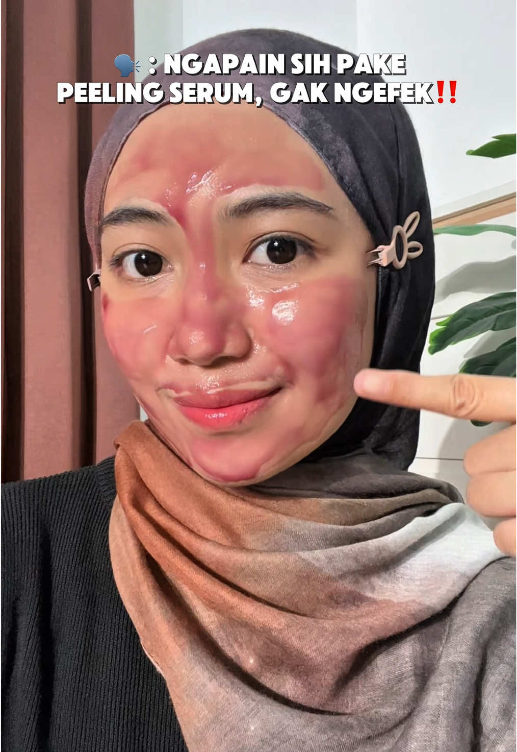 Ihhhh kata siapa gak ngefek sih😫. Nih aku udh rutin pake peelingnya @msglow.beauty , hasilnya gong bgt 😍🫶 #MSGlowbeauty #peelingserum 