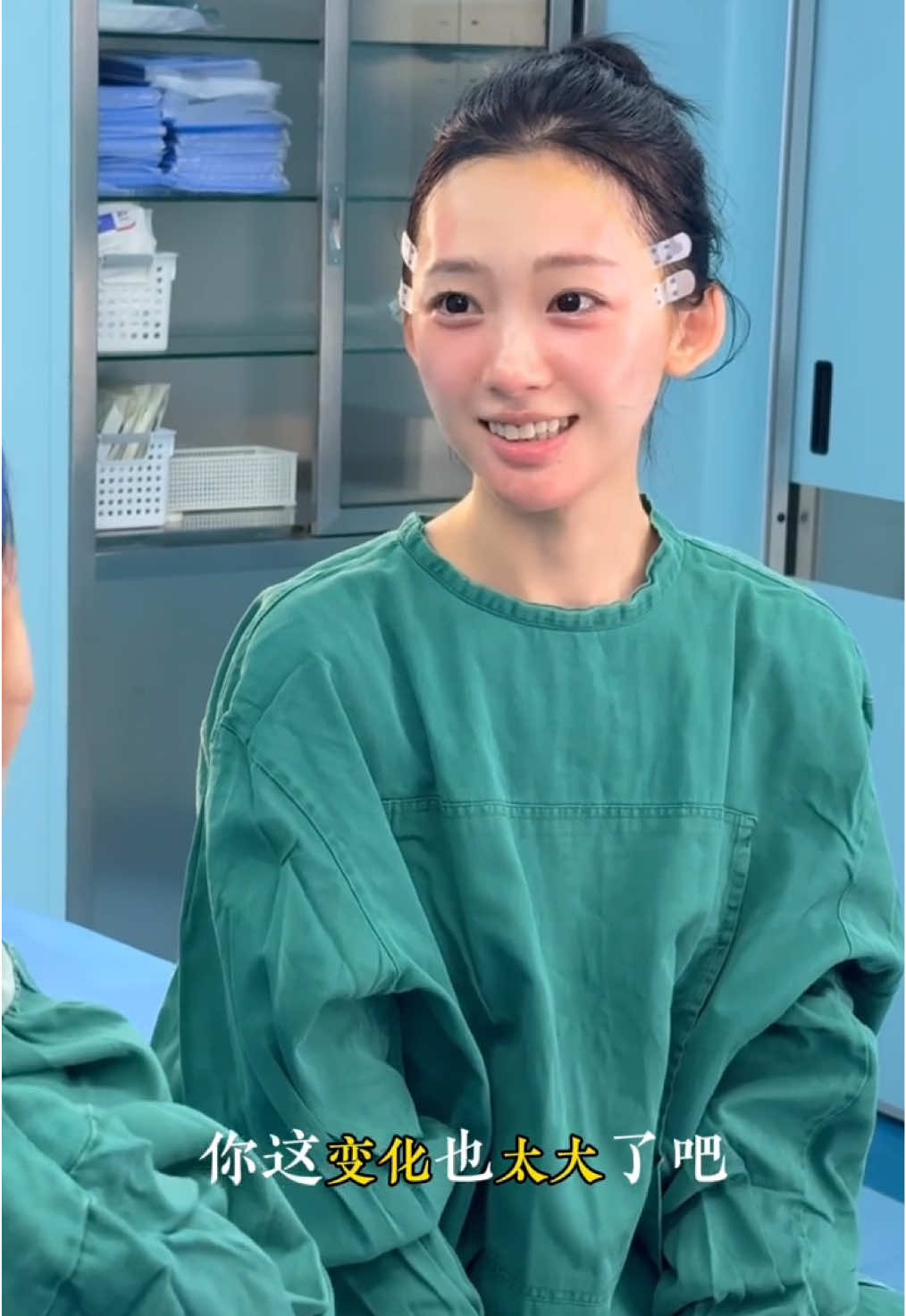 30+宝妈微调苹果肌后，老公惊呆了！ #变美#面部提升 #变美变年轻 #提升苹果肌 #筋膜提升 