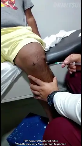 Try our bone pain patch!!!Click the link on my homepage to purchase, or search DrMitsui on Amazon to place an order #HealthyLiving #gout #goutpatch #wy #DRMITSUI