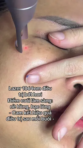 Lazer bớt hori #TikTokAwardsVN #trendingtiktok #lazer #viral #trendingvideo 