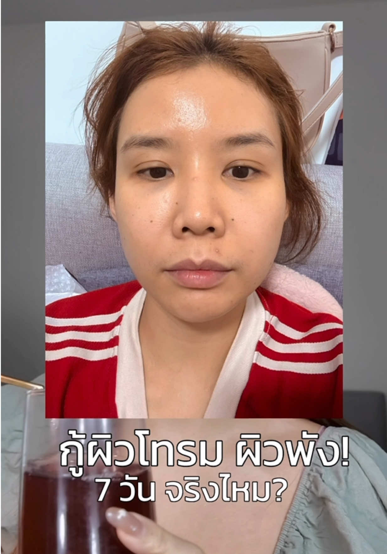 ตอบกลับ @เอมมี่คุณแม่นางฟ้า👸 คอลลาเจนกู้ผิวโทรมใน 7 วันได้จริงไหม⁉️#Collagendropdrink #คอลลาเจนดรอปดริ้งค์   #ConcentratedLiquidCollagen  #BioActiveplus #BioActiveTH  @SKINBYNAM(ลูกน้ำ)  @SKINBYNAM(ลูกน้ำ)  @SKINBYNAM(ลูกน้ำ) 