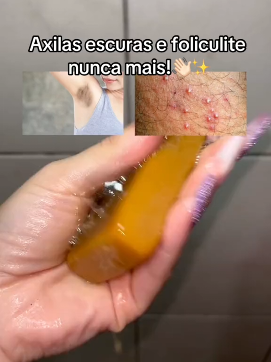 AREAS ESCURAS E COM FOLICULITE?  LINK AQUI 👇🏼 PARA ESSE SABONETE MILAGROSO! https://s.shopee.com.br/8zwoEif9dw ID: CHU-FYL-XVP #axilasescuras #foliculite #sabonete #fy 