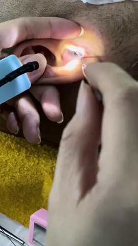 🔥🙏🥇តម្លៃពិសេសជាមួយកញ្ចប់10$ (សំអាត់ត្រចៀក + កក់សក់ +​ លាង​មុខ + បិទម៉ាស់)  និងកញ្ចប់ 15$ (សំអាតត្រចៀក + កក់សក់ + ញិចមុន + ម៉ាស្សាមុខ) https://vt.tiktok.com/ZSAFAcEjV/ 📍ទីតាំងប្អូនមានតែ 1គត់ នៅភ្នំពេញជិតផ្សារសូរិយា «ផ្សារថ្មី».  👍បញ្ជាក់ក្មេងអាយុ 3ឆ្នាំឡើងអាចយកបានបង សំខាន់ឲតែគាត់នៅស្ងៀម 📞Telegram = 081 674 455Chat  តាម​​ Page: វ៉ាន់ឌីសាឡន 081 674 455 តាមtiktok https://www.tiktok.com/@vandysalon.         🥰នេះអាស័យដ្ឋានហាង           https://maps.app.goo.gl/6As9MUMdjQUgs9Y57