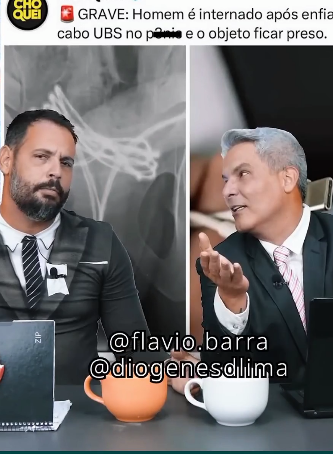 jovem introduz objetivo na uretra e precisa de ajuda médica? 😂😂 #flaviobarra #diogenes #casosreais #humorbr #videosengracados 