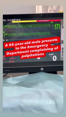 Teamwork 💬 + Rapid Action ⚡ = Saving Lives ❤️ #VentricularFibrillation #VFib #CodeBlue #EmergencyNursing #SimulationTraining