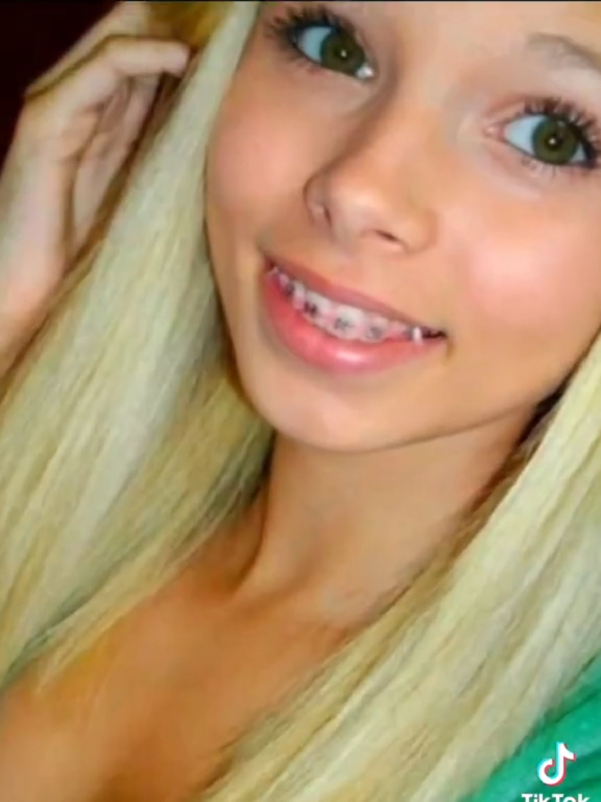 💗💗💗💖💗💗💗 🌹 ⛓️ #bracesarebeautiful #braces #braceface        🔗 #metalmouth #girlswithbraces 🔗💖🔗 ⛓️⛓️⛓️⛓️⛓️⛓️⛓️⛓️