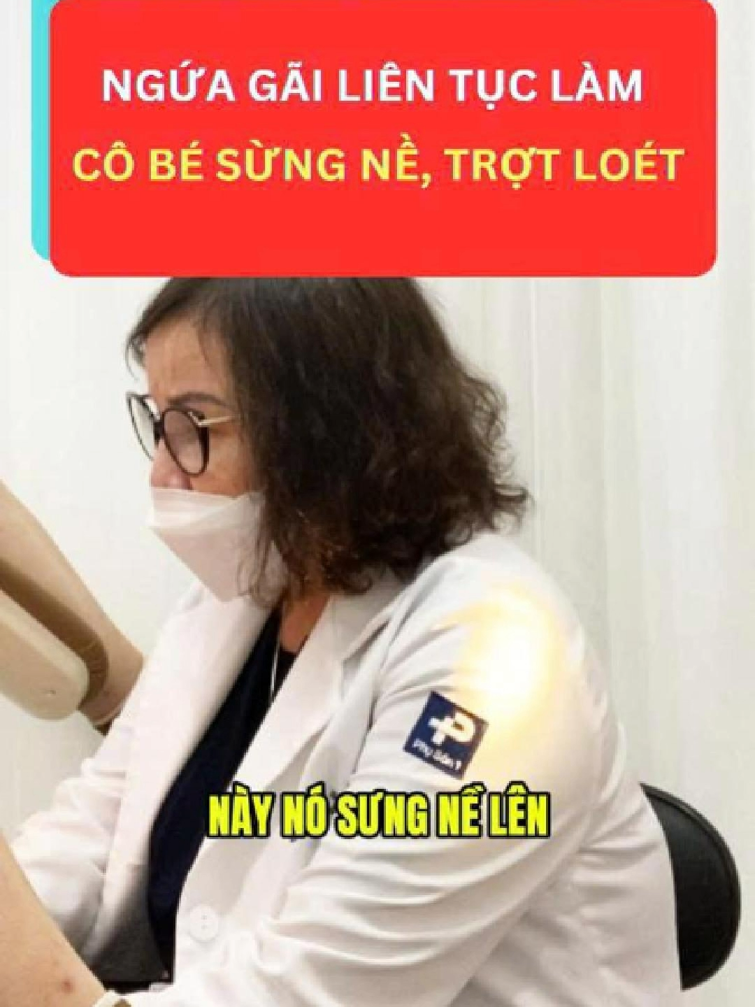 Ngứa gãi liên tục làm cô bé sưng nề, trợt l.oét #bacsidothingoclan #329bachmai #bacsingoclansanphukhoa #viemphukhoa #bacsingoclan #phusan1 #xuhuong #thinhhanh