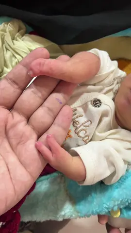 Can We Prevent Hand Anomalies in Babies? Most cases happen naturally — not anyone’s fault لیکن چند احتیاطیں مددگار ہو سکتی ہی ✔ حمل سے پہلے فولک ایسڈ لیں ✔ غیر ضروری دوائیں، سگریٹ یا الکحل سے پرہیز کریں ✔ ریگولر الٹراساؤنڈ اور چیک اپ کروائیں ✔ تابکاری یا زہریلے مادوں سے بچیں Healthy pregnancy → Healthy baby