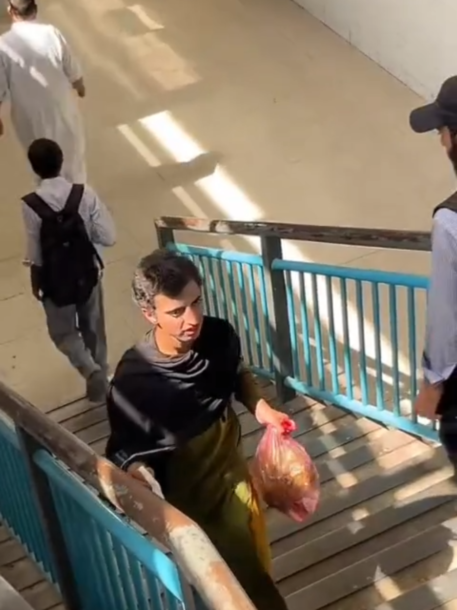 یہ  کم عمر خواجہ سرا  عمیر عرف شایان تشدد کا شکار ہوگیا ہے اور اس وقت سیدو شریف ہسپتال میں زیر علاج ہے  ذرائع کیمطابق اس کے دانت ٹوٹ چکے ہیں، اسپائنل کارڈ فریکچر ہوچکا ہے، اور وہ معذوری کے خطرے سے دوچار ہے۔ #viralvideo #foryou #fypシ  #pakistan #swat  
