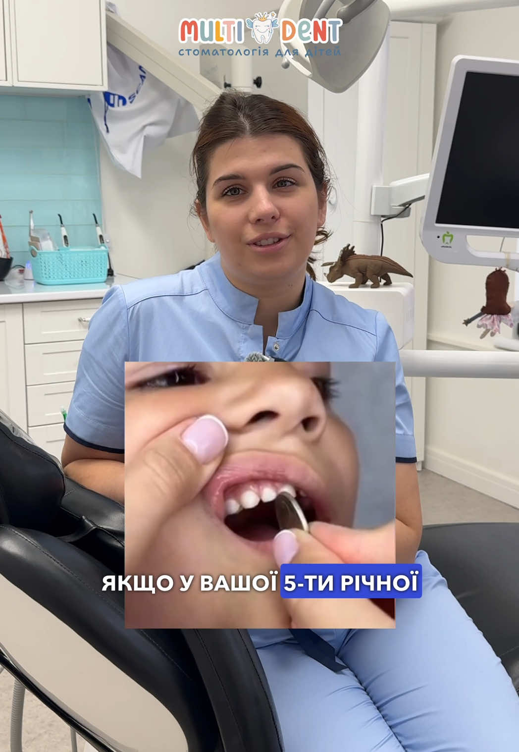 Якщо у вашої 5-річної дитини немає проміжків між зубками… 🦷 У нормі в цьому віці між молочними зубами мають бути помітні проміжки — так звані щілинки росту. Вони потрібні для того, щоб постійним зубам вистачило місця, коли вони почнуть прорізуватися. 🔍 Якщо ж зубки стоять щільно, “як у дорослого”, і між передніми навіть не проходить тонка монетка, — це сигнал, що щелепа занадто вузька. ❗️У такому випадку дитині потрібне ортодонтичне розширення щелепи — найчастіше за допомогою апарата Марко Россо. Він м’яко й поступово розширює верхню щелепу, створює місце для постійних зубів і допомагає уникнути скупченості в майбутньому. 🦷 Чим раніше почати, тим простіше й ефективніше результат! #ортодонт #дитячийстоматолог #стоматологкиїв #стоматолог #мультидент 