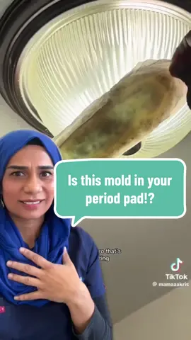 Is this mold in your #period #pad??!!  Period tampons, pads have been in existence for over 60 years- there is rigorous checks on products, safety standards & strict hygienic rules during their production.  This viral video is showing the absorption fibres in a pad under the light.  The real scandal is that we still don’t know what’s a normal period. How to manage heavy periods and only in 2023 some period product brands started using REAL blood 🩸 #CapCut 