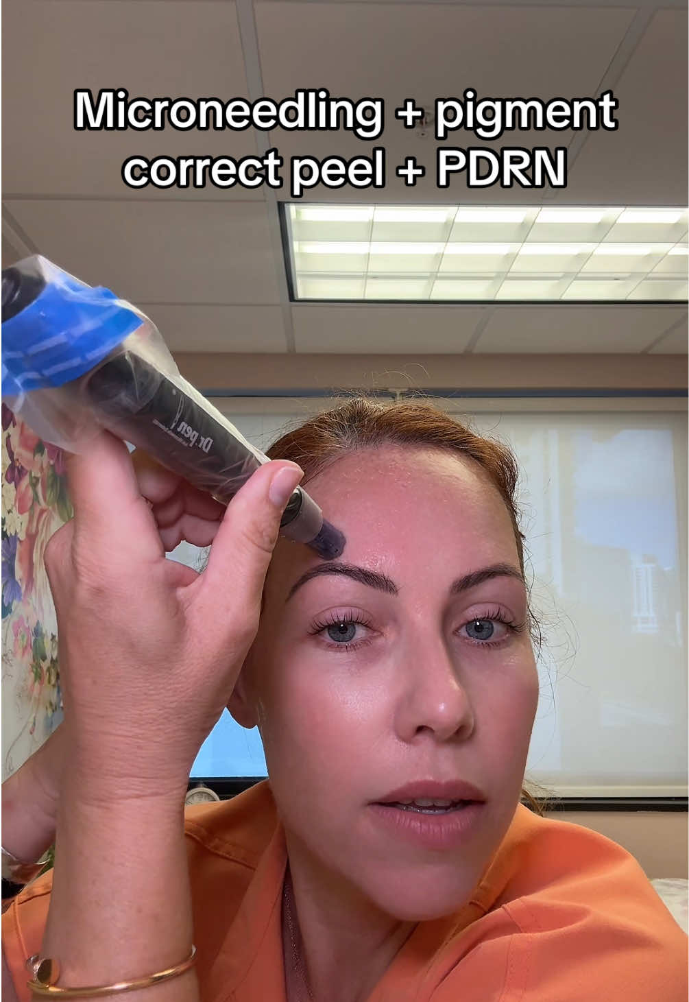 Advanced skincare treatments 🤗 #skincare #advancedskincare #microneedling #PCAskinpeel #miami 