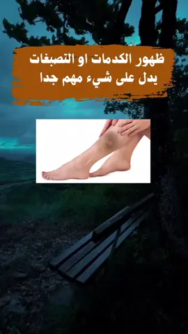اسباب‌ ظهور الكدمات والتصبغات #الراقي_ابو_عمر_السامرائي 