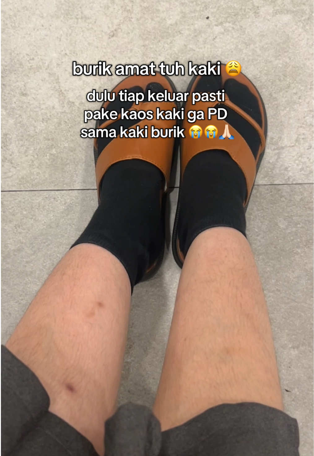 ga tau knp pokoknya kalau kulit cerah tuh makin nambah aja nih percaya diri 🥹💕💕#fyp#creambekasluka #ciaraindonesia #fypage #masukberanda 