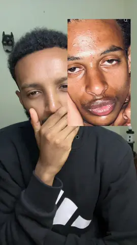 #habeshatiktok #ethiopian_tik_tok #viral #fyp 