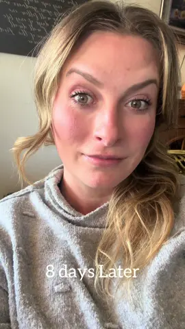 Ghosting fine lines this spooky season 👻✨ I just visited @LaserAway for Botox and I’m feeling refreshed, confident, and ready to glow into the holidays. What I love most is how safe, inclusive, and personalized every treatment is! If you’ve been curious, now is the time! Their Spookiest Sale of the year is here: ✨ $9 per unit Botox ✨ 70% OFF Laser Hair Removal (select areas) ✨ 20% OFF Thermage, Clear + Brilliant & RF Microneedling Confidence is for every body, every tone, every journey! #AllSkinAllIn #LApromotion  (Gifted Service)