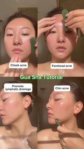 📌Save this if you have acne✨ Remember to not go directly over active pimples, work around them to release heat and help your skin heal from the inside out! 