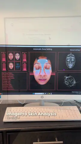 There is more to your skin than meets the eye.  Our Emage Skin Analysis Machine provides a detailed look into your skin’s health, including hydration, pores and texture, UV damage, pigmentation, elasticity, and potential future concerns. This advanced, professional tool allows us to create a personalized skincare plan based on measurable results. Disclaimer: This analysis is for informational purposes only and is not a medical diagnosis. Please consult a healthcare professional for any skin concerns. #HonestBeautyLLC #WestHartfordCT #SkinAnalysis #CTEsthetician    