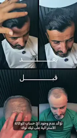 للحجز والاستفسار الأتصال بالرقم 07881280547