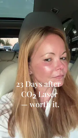 I cannot believe what I looked like 23 days ago.  🫣 From Day 1 to Day 23, the transformation is dramatic. Watch the CO2 laser results unfold. #beforeandafter #CO2Laser #skintok #glowskin #aesthetics #skincaretiktok  #glowingskin #glassskin #beautyroutine #skincaretips #skincaregoals @EvolvMD MedSpa & Wellness 