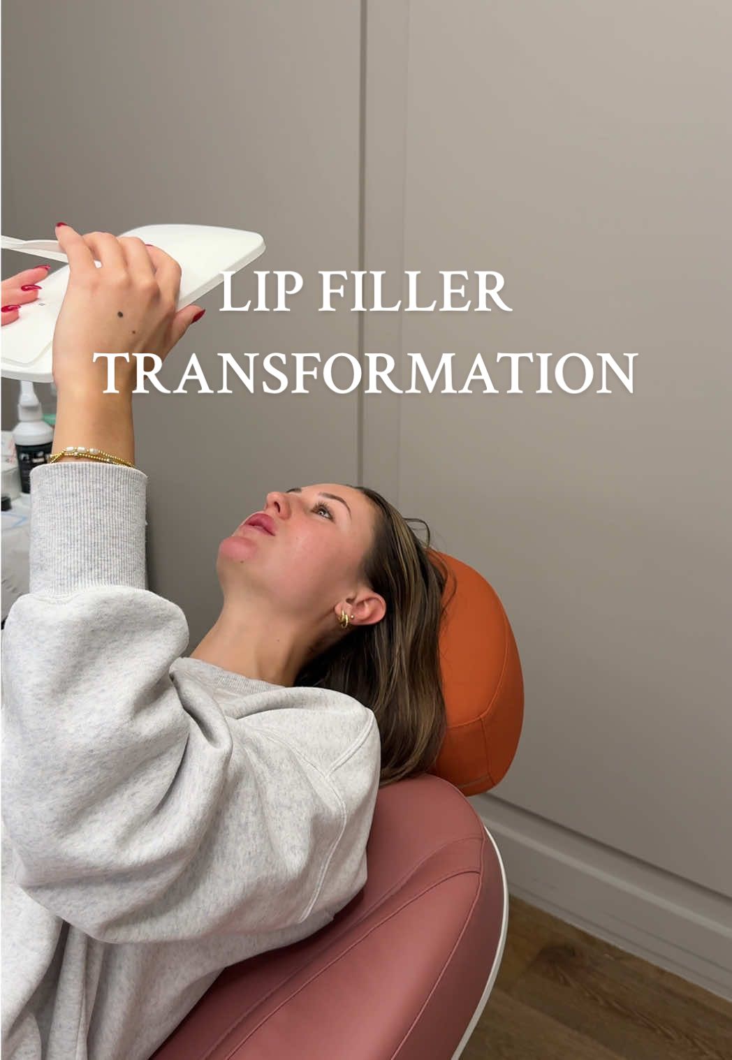 Stay turned for the results in 2 weeks:) 👄💉 @Plump Cosmetics & Injectables @Injectables_by_TheMrsAlyss  #hoboken #newjersey #injectables #botox #lipfiller 
