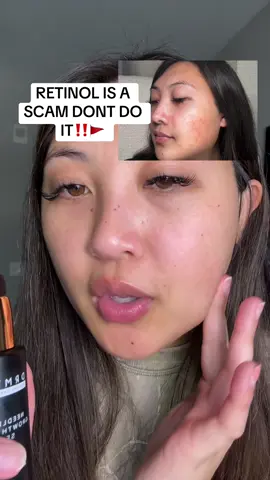 THIS is the best alternative to “vampire facials”  #drmtlgy #growthfactorserum #tiktokshopcreatorpicks #skincare #aginggracefully 