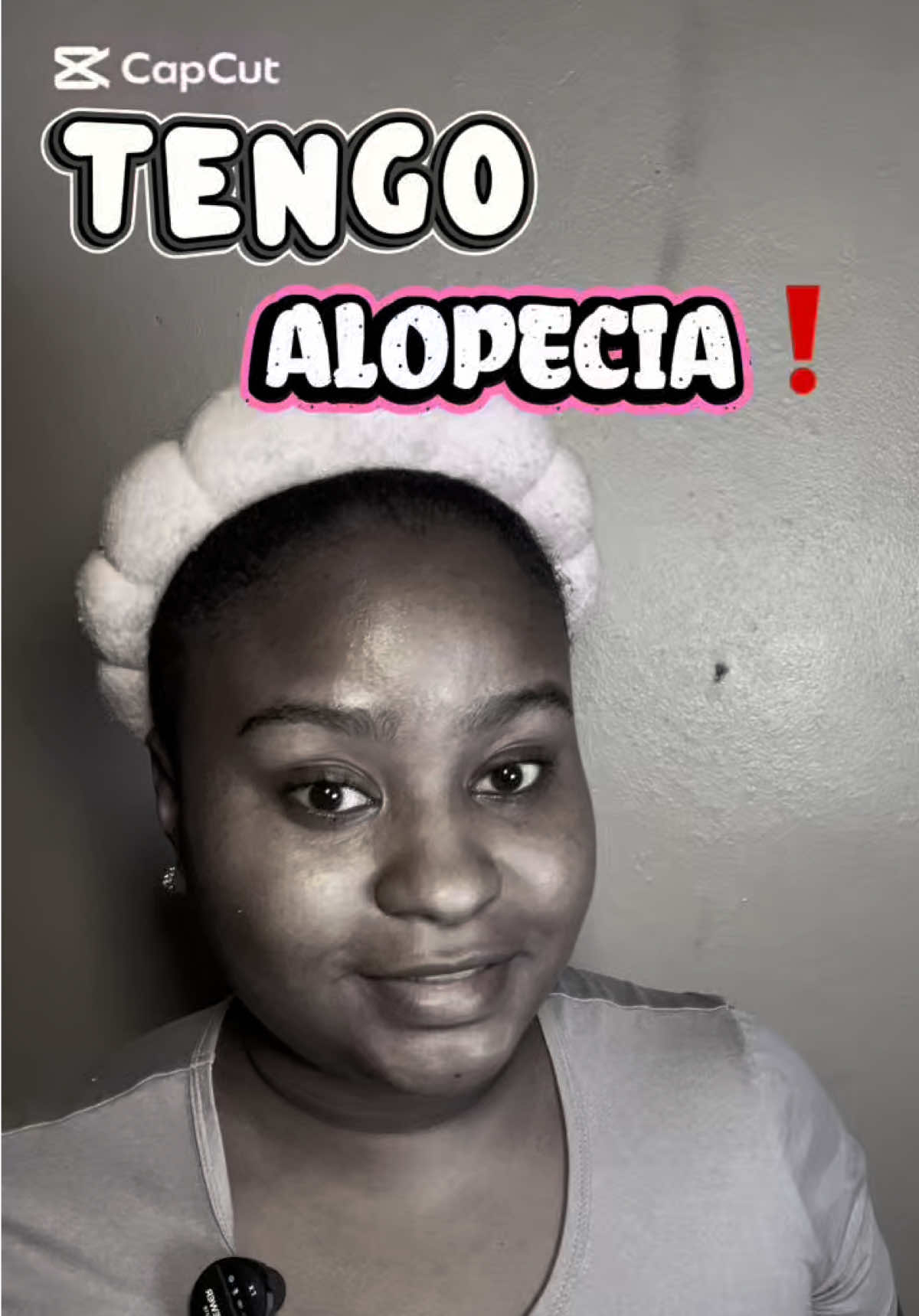 TENGO ALOPECIA AREATA  Unas de las principales causas es el estrés, abandone el proceso y no le di mucha importancia. Hasta que decidí comenzar a tratar con esta loción  de @Labcapilo y me ha ayudado bastante. 😮‍💨😮‍💨 #alopecia #alopeciaareata #fyp #goteroparaelcrecimiento #fypシ゚viral  