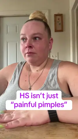 This is HS #hidradenitissuppurativaawareness #hidradenitissuppurativawarrior #hswarrior #HS Products mentioned are in my pinned video & from @Pistachio Hair & Body Wonders 