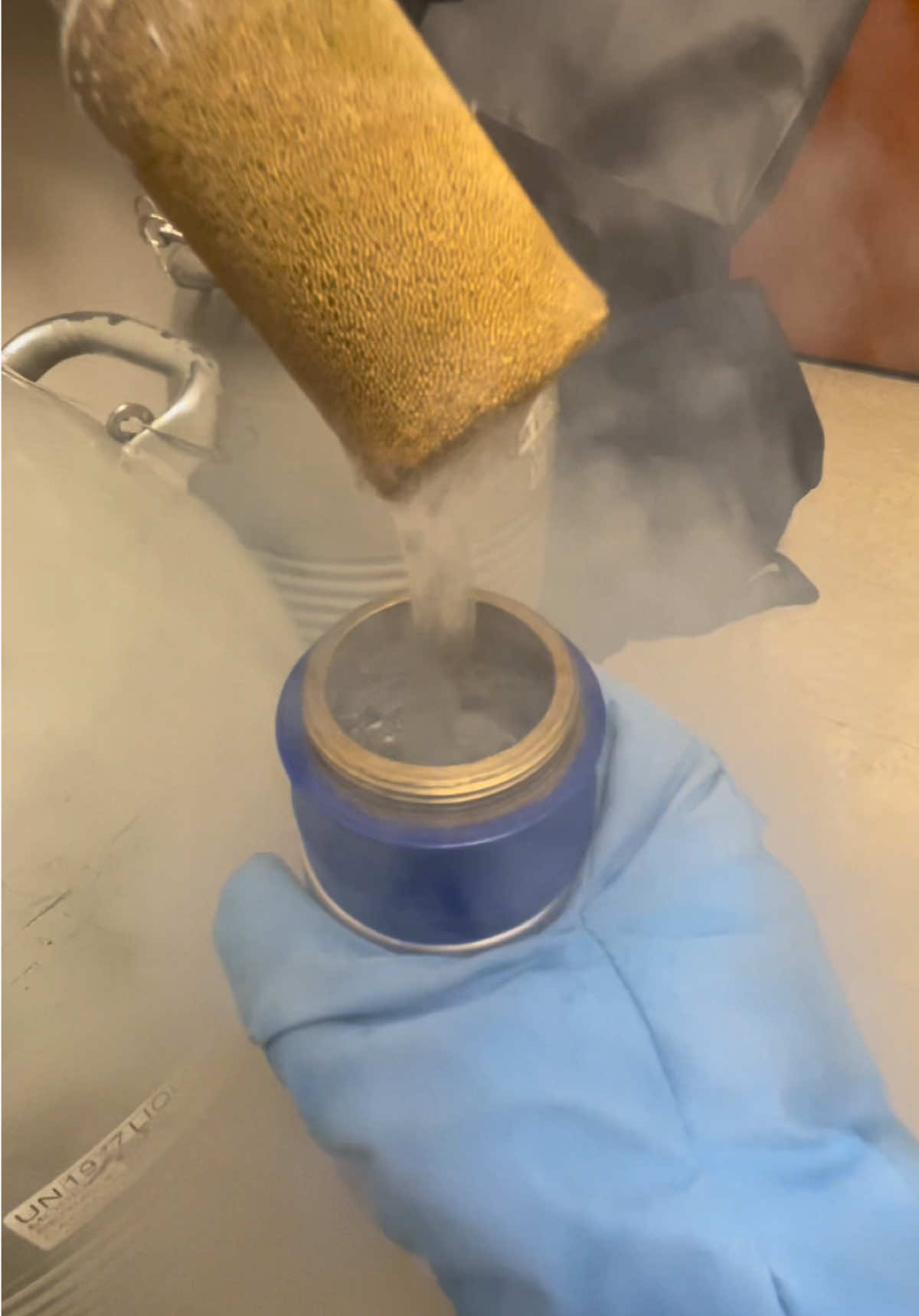 Liquid Nitrogen ASMR 🌧️👩🏻‍⚕️ #dermatologist #fyp #medical #skin #doctor 
