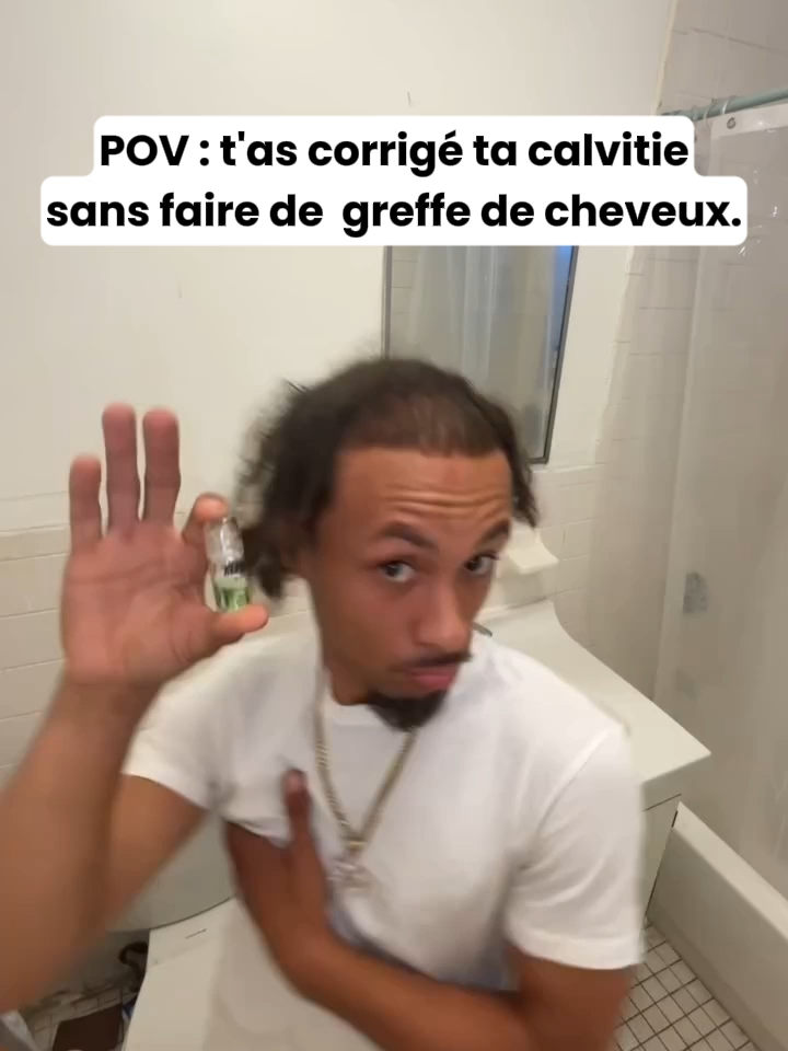 Retrouvez vos cheveux, votre densité et votre confiance grâce à Leralia. Micro-aiguilles + sérum naturel pour des résultats visibles en quelques mois. (LIEN EN BIO) #cheveux #calvitie #poussedecheveux #hairregrowth #hairregrowthtreatment #hairloss #pertedecheveux